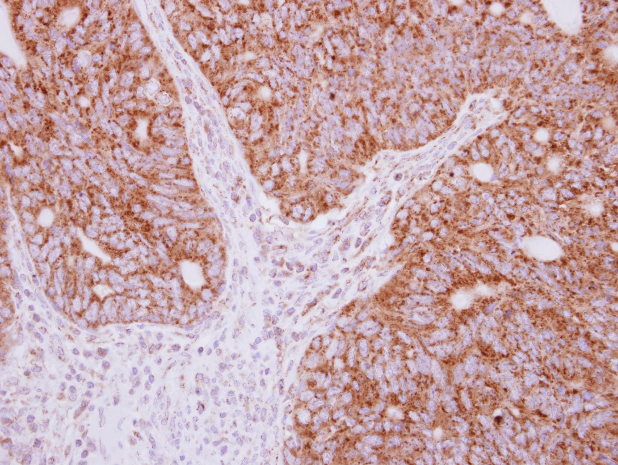 Polyclonal Rabbit anti-Human YARS2 Antibody (IHC, WB)