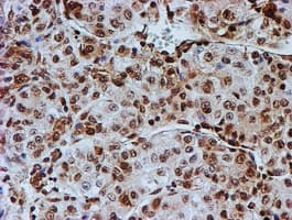 FMR1 / FMRP Antibody (clone OTI3B4)