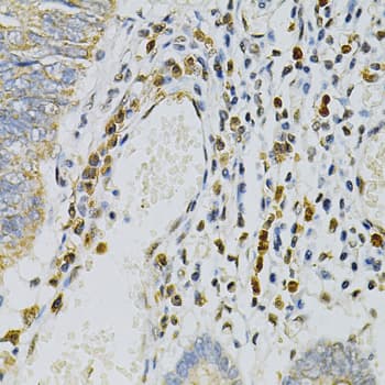 CDA / Cytidine Deaminase Antibody