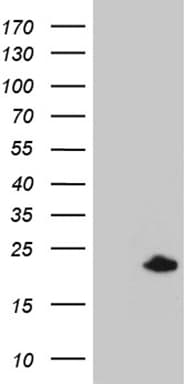 Monoclonal Mouse anti-Human SPANXB1 Antibody (clone OTI1E11, Carrier-free, IHC, WB)