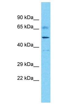 DDX52 Antibody (aa545-594)