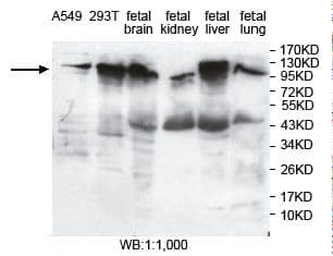 PITRM1 / MP1 Antibody (aa679-925)