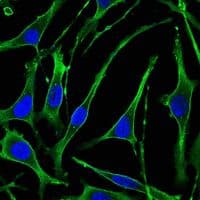 PTHR / PTHR1 Antibody (clone 4D2)
