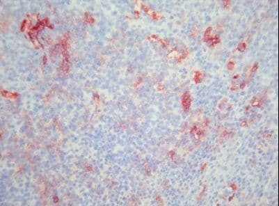 ITGAM / CD11b Antibody (clone X-5)