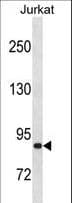 ZNF337 Antibody (aa713-739)