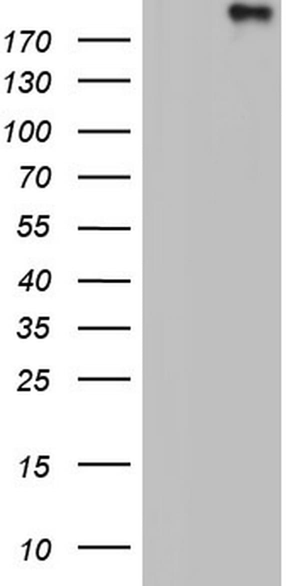 VWF / Von Willebrand Factor Antibody (aa764-1263, clone OTI2D10)