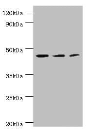 Polyclonal Rabbit anti-Human ACY1 / Aminoacylase 1 Antibody (aa1-408, IHC, WB)