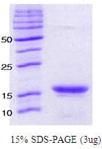 Human SNCA / Alpha-Synuclein Protein (Recombinant)
