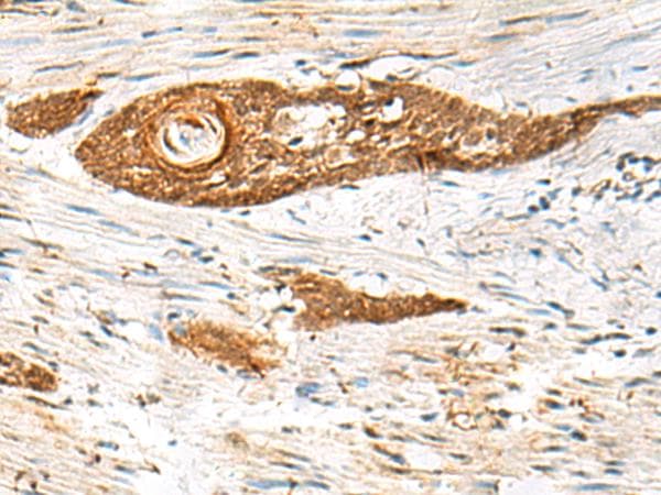 GPSM1 / AGS3 Antibody