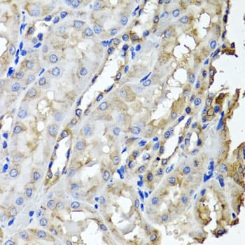 SCYL1 / NTKL Antibody