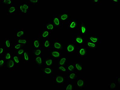 HIST1H2BN Antibody