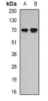 SCG2 / Secretogranin II Antibody