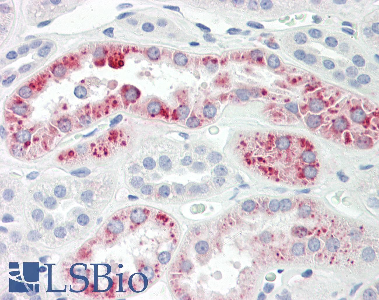 IHC-plus™ Polyclonal Rabbit anti-Human PIGH Antibody (aa137-186, IHC)