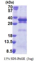 Human LRRC59 Protein (Recombinant His)