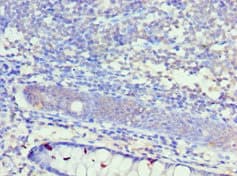 KCNN4 / KCa3.1 Antibody (aa288-427)