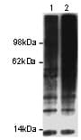 Ubiquitin Antibody (clone P4D1)