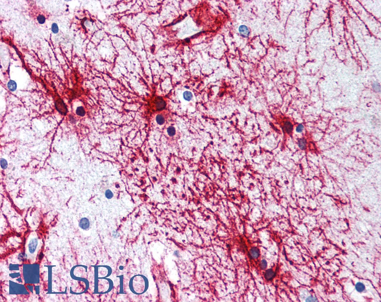 PathPlus™ GFAP Antibody (aa417-430)