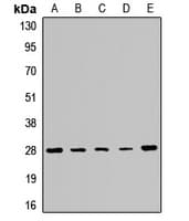 PMM2 Antibody