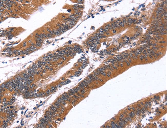 Polyclonal Rabbit anti-Human GREB1 Antibody (IHC)