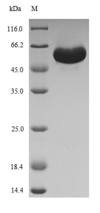 Spinach RuBisCO activase Protein (Recombinant 6His-SUMO, N-terminus)