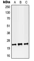Polyclonal Rabbit anti-Human RAB38 Antibody (Internal, WB)