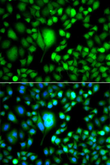 IHC-plus™ CSRP2BP Antibody