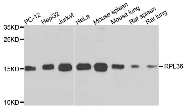 Polyclonal Rabbit anti-Human RPL36 / Ribosomal Protein L36 Antibody (IHC, WB)