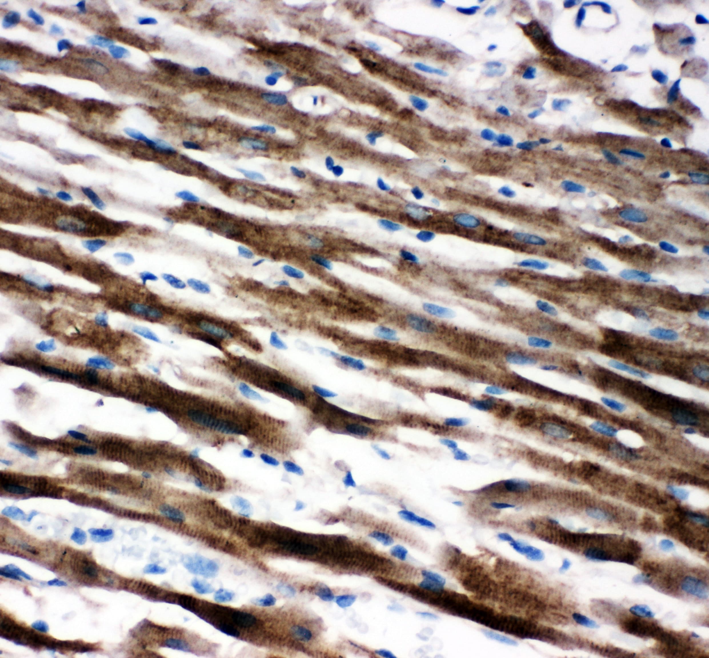 Polyclonal Rabbit anti-Human AIFM1 / AIF / PDCD8 Antibody (aa596-613, IHC, WB)