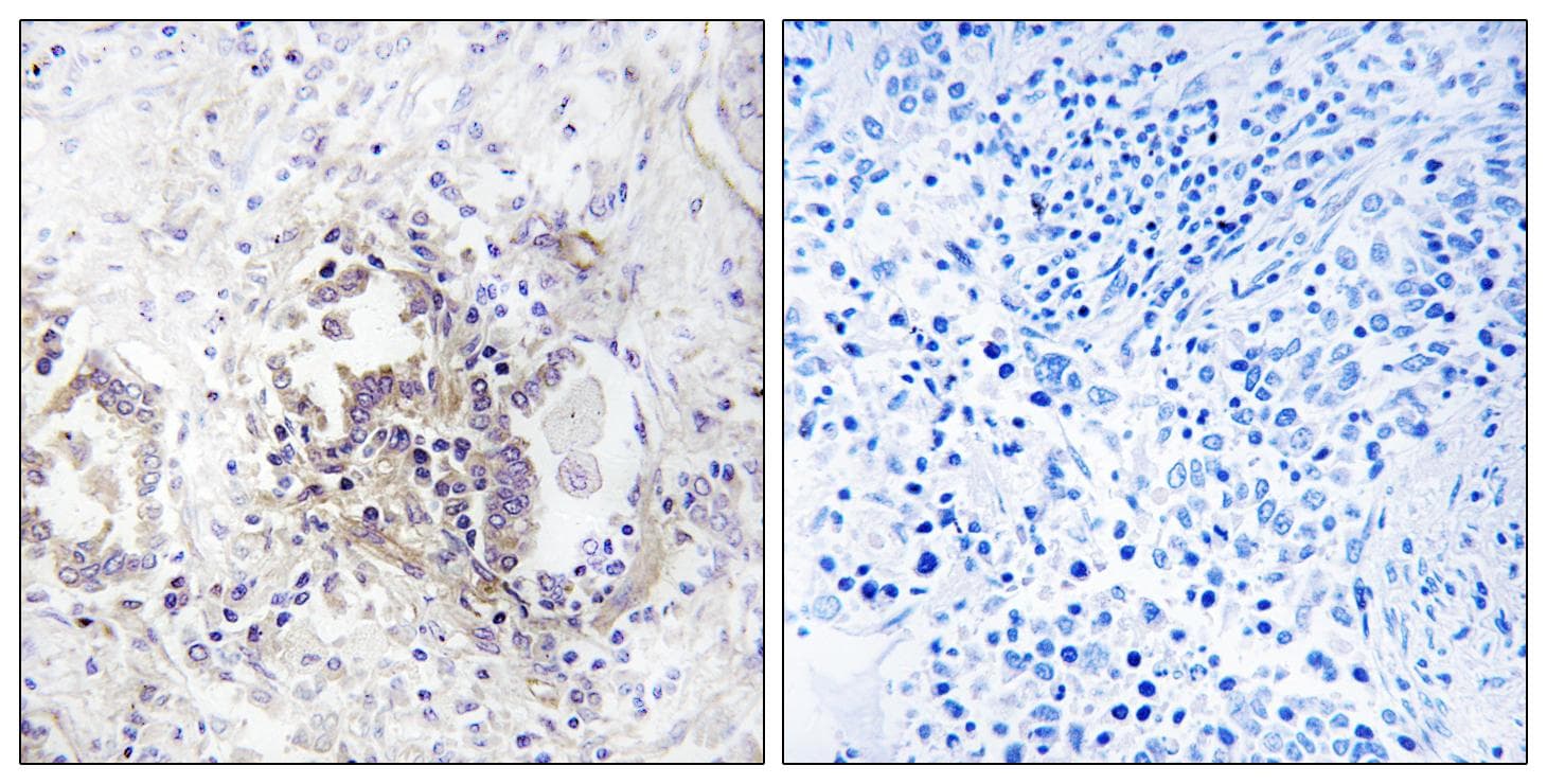 CHML Antibody