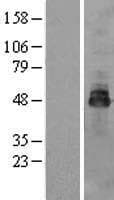OSTM1 Protein (Over-Expression Lysate Myc-DDK (Flag))