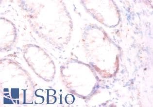 FOLH1 / PSMA Antibody (Biotin)