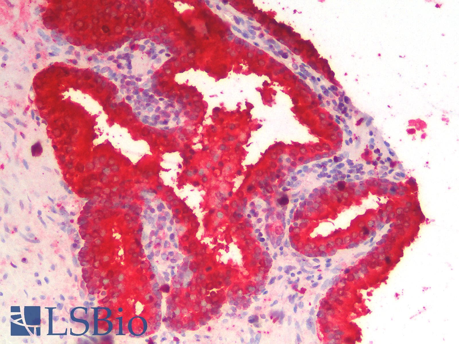 PathPlus™ ACPP / PAP Antibody (clone rACPP/1338)