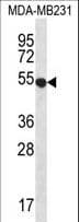 IHC-plus™ GPR34 Antibody (aa232-261)