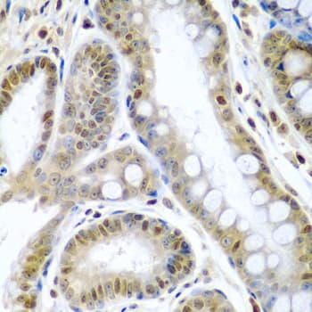 TNFSF10 / TRAIL Antibody