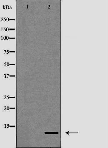 S100A12 Antibody