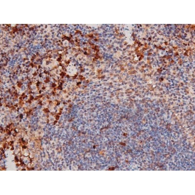STAT3 Antibody (phospho-Ser727)