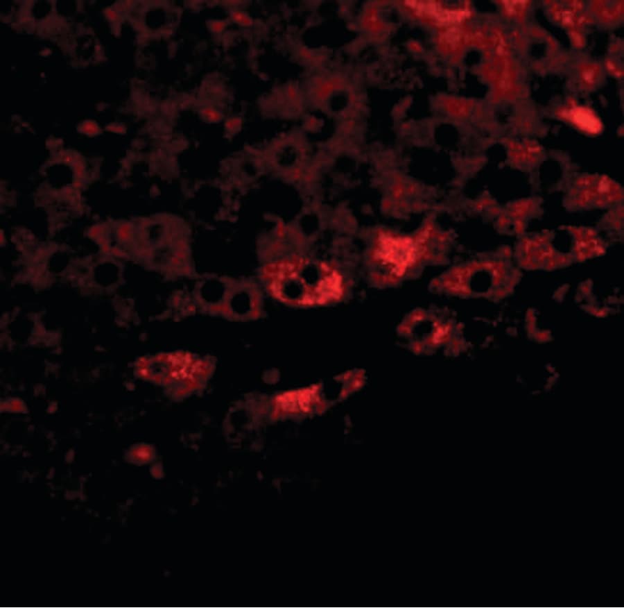 Polyclonal Rabbit anti-Human TBKBP1 Antibody (IHC, IF, WB)