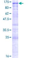 Human CARF / ALS2CR8 Protein (Recombinant GST)