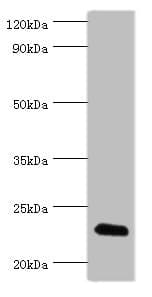FGF6 Antibody (aa38-208)
