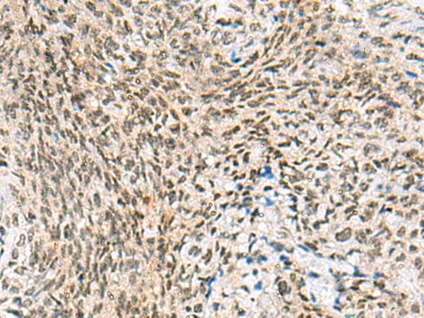 Polyclonal Rabbit anti-Human C3orf38 Antibody (IHC)
