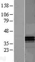APOF / Apolipoprotein F (Over-Expression Lysate Myc-DDK (Flag))