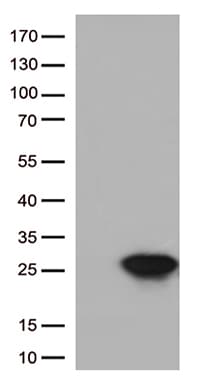 CTAG1B / NY-ESO-1 Antibody (clone UMAB73)