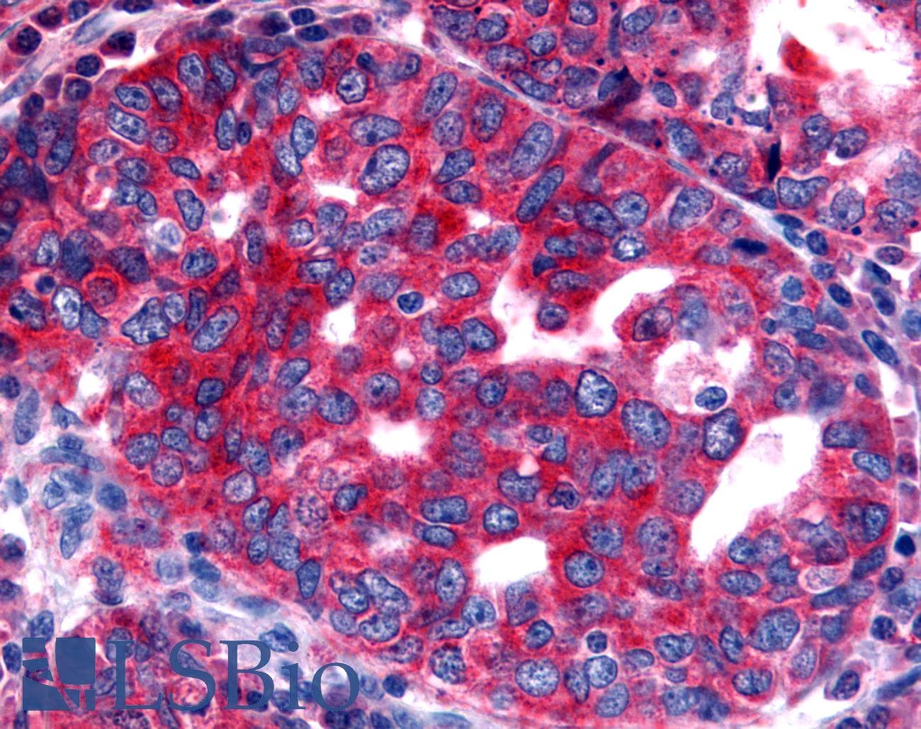 PathPlus™ NTSR2 / NTR2 Antibody (Extracellular Domain)
