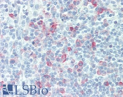 IHC-plus™ FCGR3B / CD16B Antibody (aa12-47)