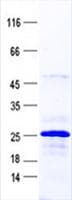 Human RPL21 / Ribosomal Protein L21 (Recombinant His, N-Terminal)