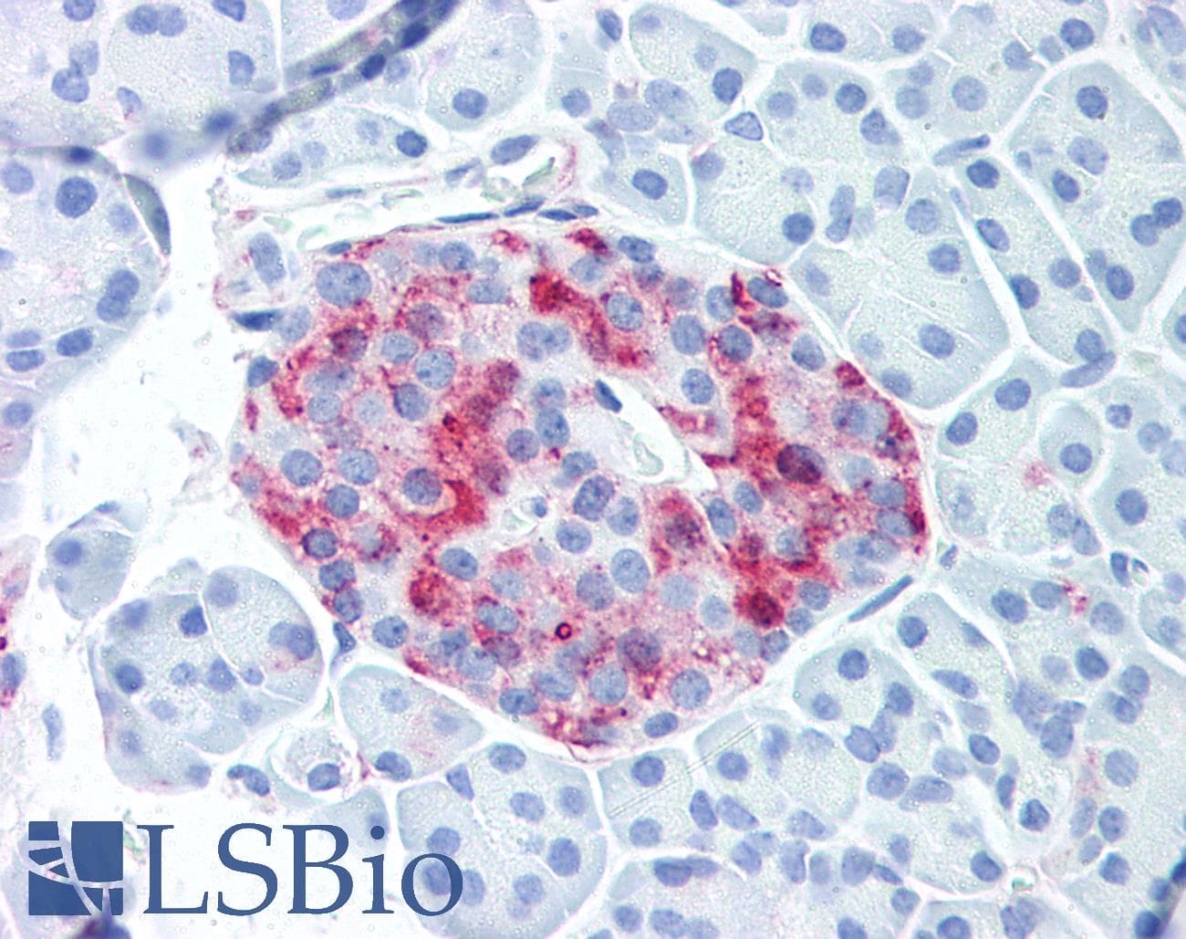 IHC-plus™ WNT10A Antibody (Internal)