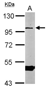 Polyclonal Rabbit anti-Human OSBPL1A / ORP1 Antibody (aa888-950, IHC, WB)