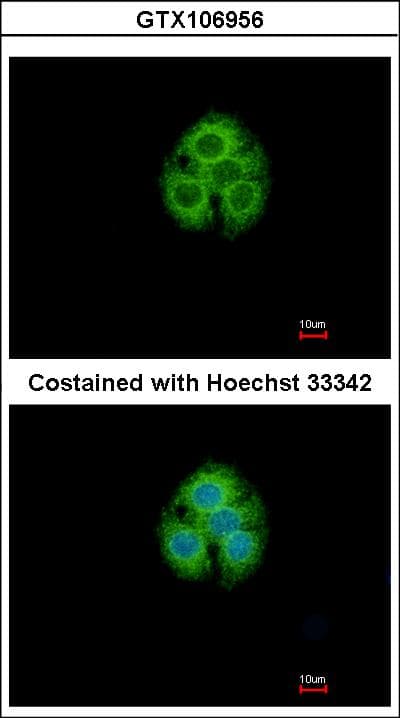 IHC-plus™ GLYATL1 Antibody (aa73-302)