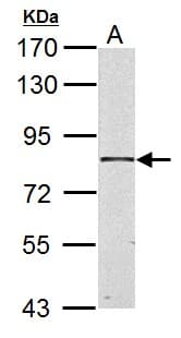 Polyclonal Rabbit anti-Human HSD17B4 Antibody (aa355-645, IHC, WB)
