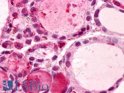 IHC-plus™ ADGRG1 / GPR56 Antibody (N-Terminus)